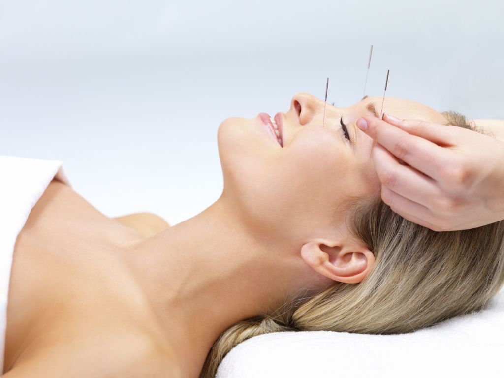 Acupuncture for Headaches and Migraines Back to Health