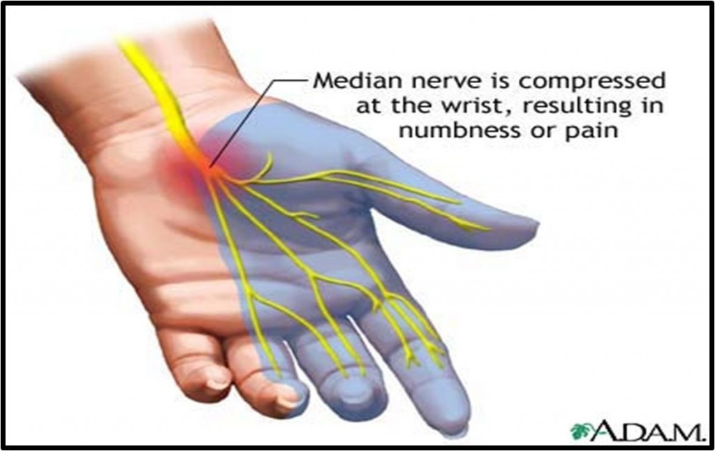 Numbing Tingling Burning Pain Back To Health Wellness Centre   Cts 1024x646 